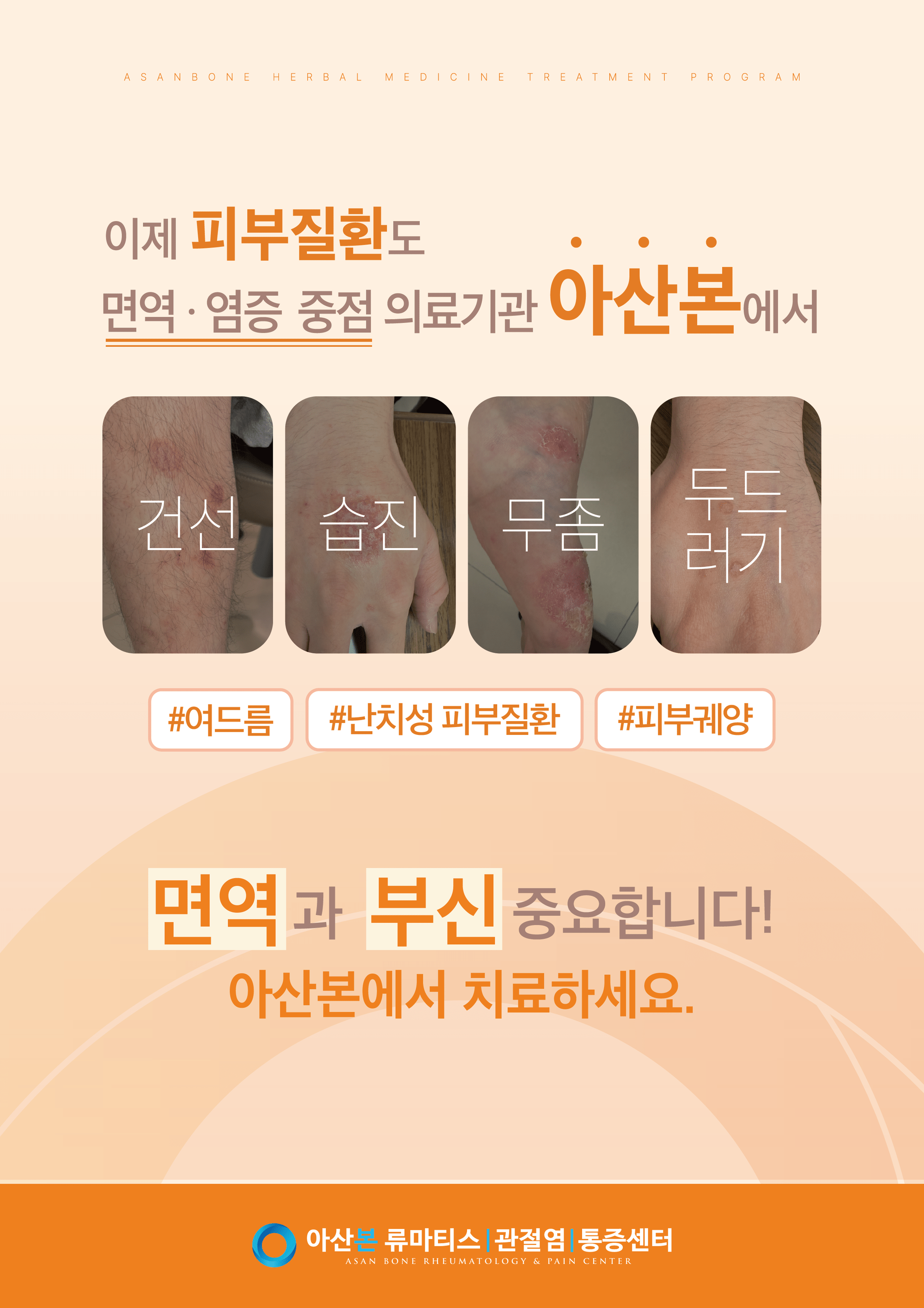 피부.png