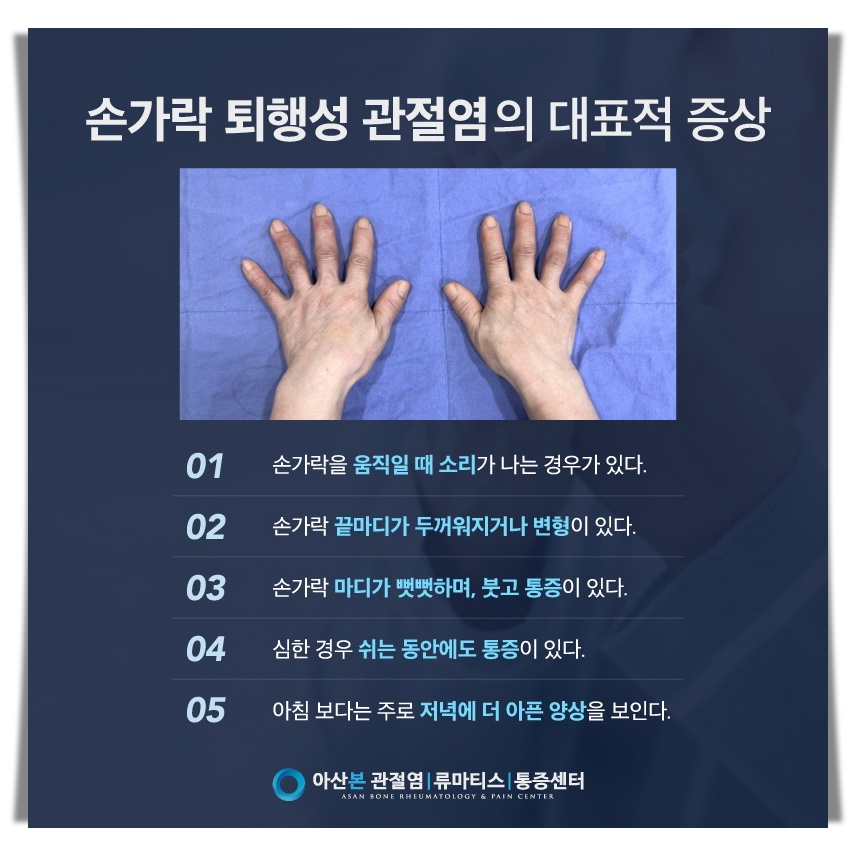 손가락 퇴행성 관절염 증상