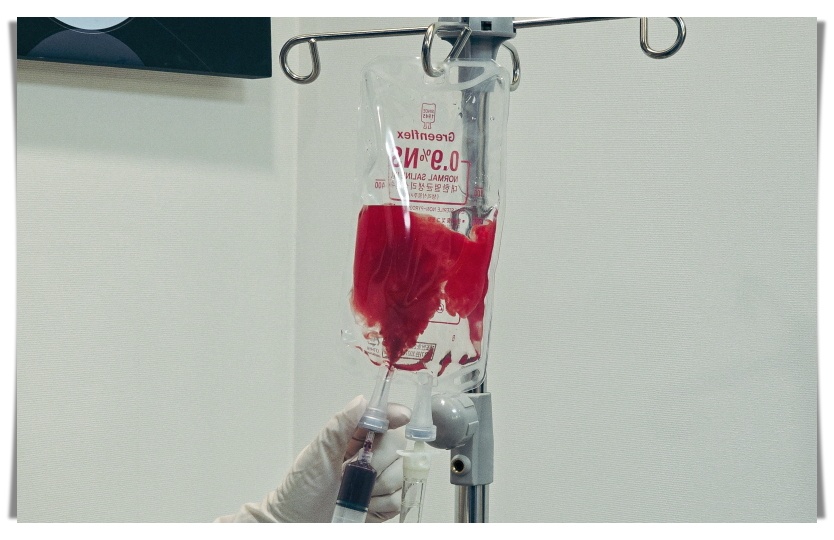 줄기세포 수액 사진