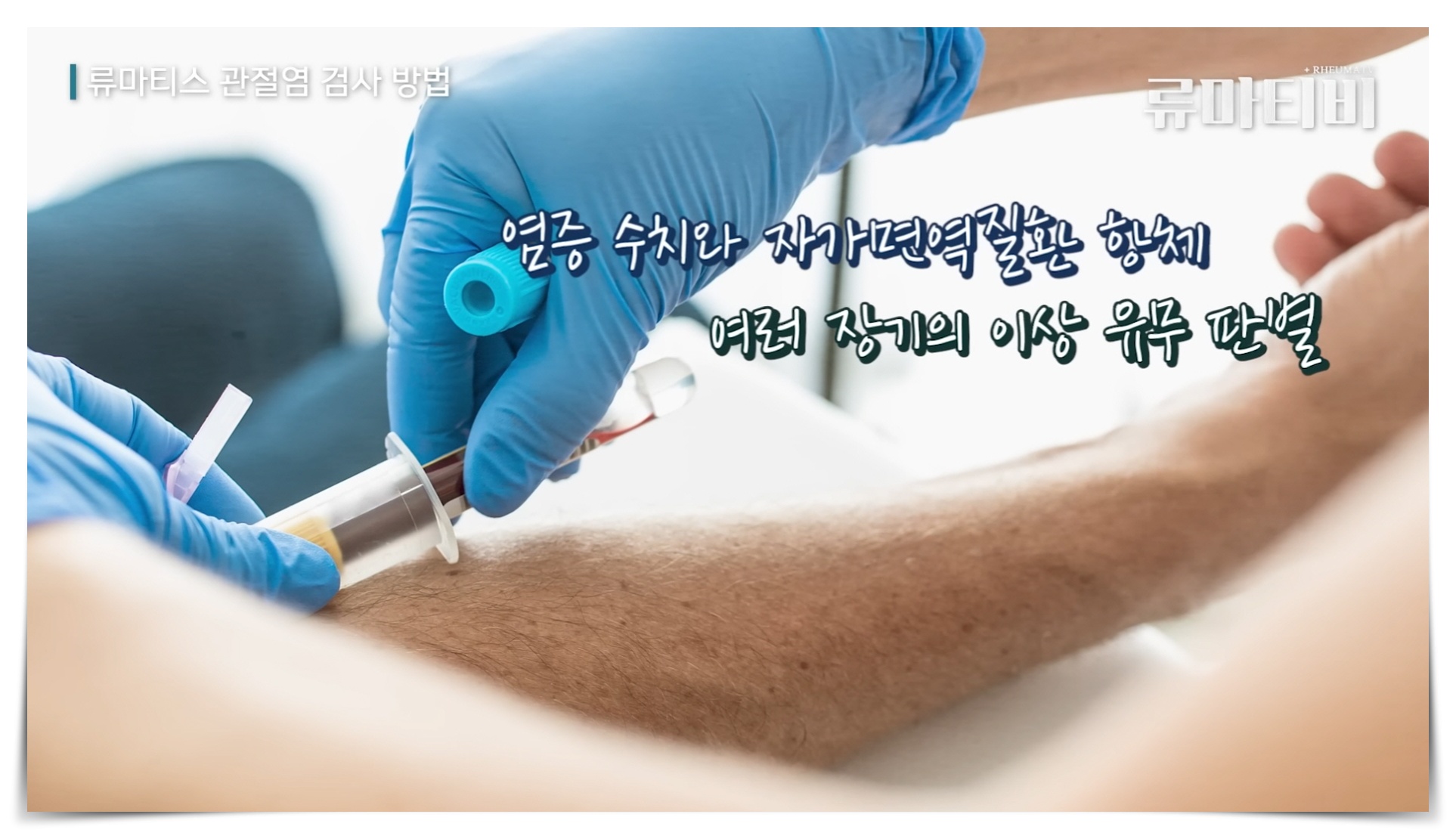 류마티스내과 검사 중 혈액검사에서 확인할 수 있는 지표 설명