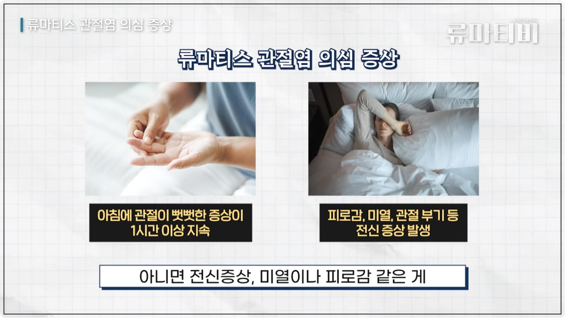 류마티스 관절염의 대표적인 초기신호