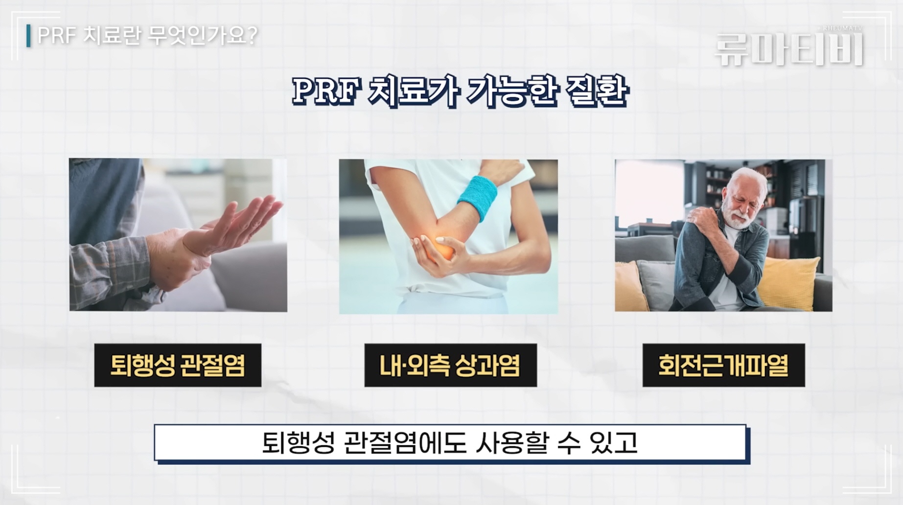 무릎 통증 치료 방법인 활성화 세포 치료 적용 질환