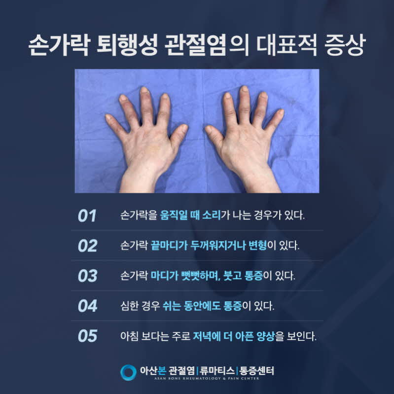 손가락 관절염 대표 증상