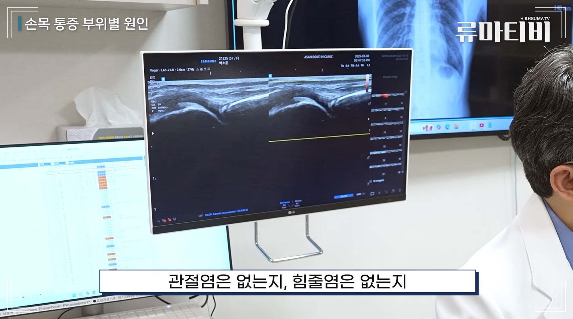 손목 꺾을 때 통증 원인, 관절 병원 추천 아산본내과의원 관절 초음파 검사 장면
