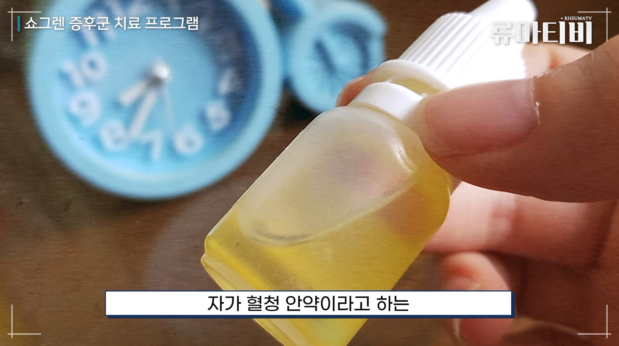안구건조증 해결 위해 쇼그렌증후군 진료과 아산본내과의원이 진행하는 자가 혈청 안약 치료